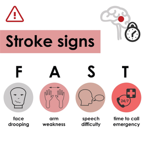 Signs of stroke training course