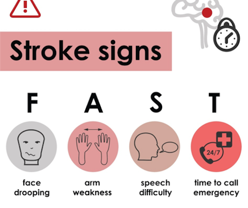 Signs of stroke training course